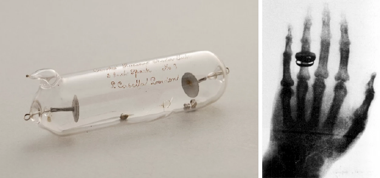 Fig. 1 – Ampola de Crookes (créditos de José Meneses) - à esquerda. A primeira radiografia, realizada em 1895, da mão de Anna Bertha Röntgen, esposa do descobridor, Wilhelm Conrad Röntgen (in: https://raiosxis.com/primeira-radiografia) - à direita